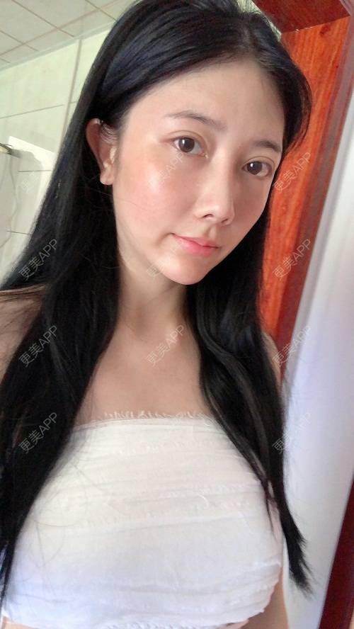 更美用户g4r11lcqv9的丰胸隆胸日记