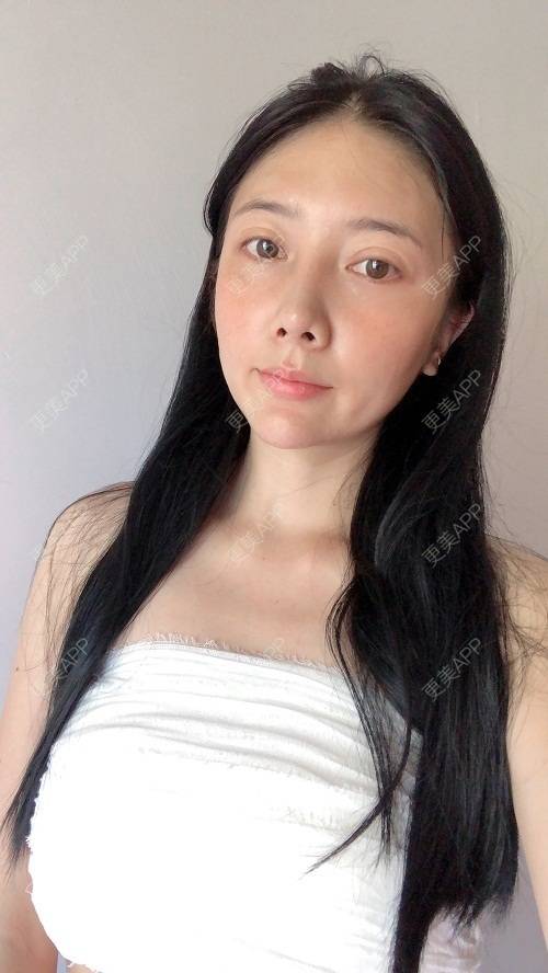 更美用户g4r11lcqv9的丰胸隆胸日记