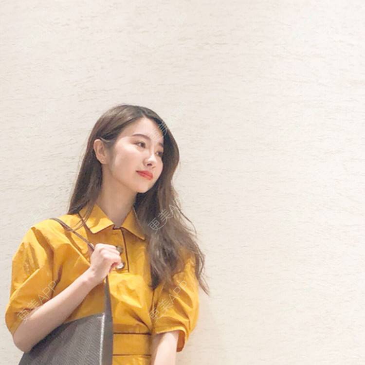更美 - Angel姐的真皮隆鼻经验 | 北京 | 视频日记 | 真皮隆鼻