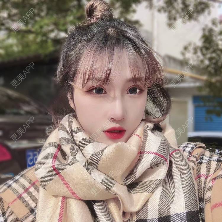 更美 - 萤萤如画的颧骨内推经验 | 广州 | 颧骨内推 | 视频日记