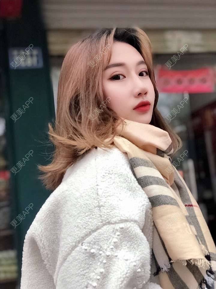 更美 - 萤萤如画的颧骨内推经验 | 广州 | 颧骨内推 | 视频日记