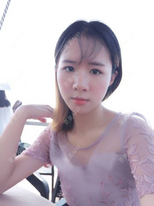 更美 - 更美用户y7L5mSdiiG的埋线提升经验 | 埋线提升 | 广州