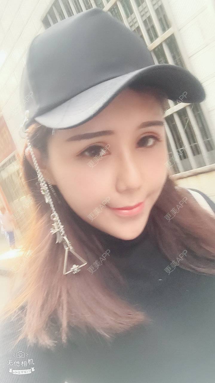 更美 - 泡面MM的鼻部膨体假体取出经验 | 鼻部膨体假体取出 | 视频日记 | 重庆