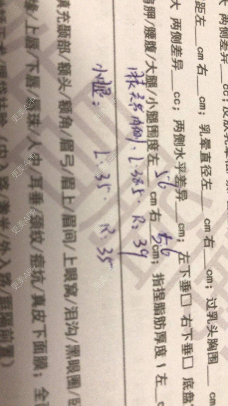 更美 - 更美用户TTx0mKb4QJ的吸脂瘦大腿经验 | 吸脂瘦大腿 | 广州