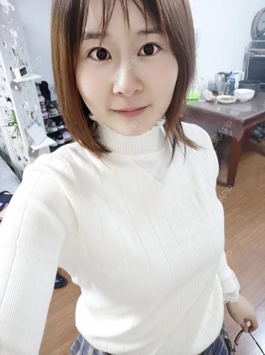 更美 - 更美用户srpv6JiXYY的玻尿酸苹果肌经验 | 玻尿酸苹果肌 | 上海