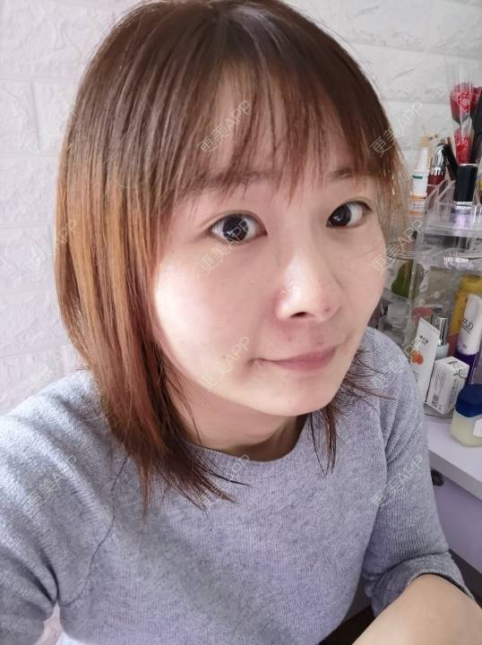 更美 - 更美用户srpv6JiXYY的玻尿酸苹果肌经验 | 玻尿酸苹果肌 | 上海