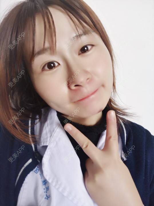 更美 - 更美用户srpv6JiXYY的玻尿酸苹果肌经验 | 玻尿酸苹果肌 | 上海