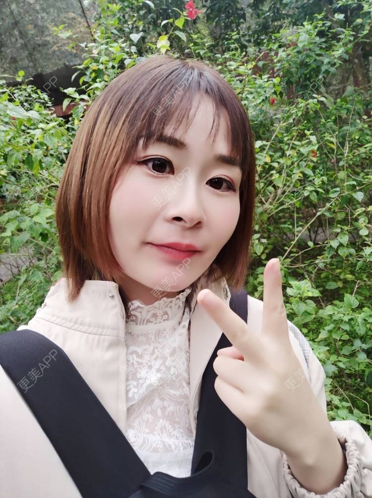 更美 - 更美用户srpv6JiXYY的玻尿酸苹果肌经验 | 玻尿酸苹果肌 | 上海