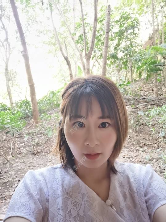 更美 - 更美用户srpv6JiXYY的玻尿酸苹果肌经验 | 玻尿酸苹果肌 | 上海