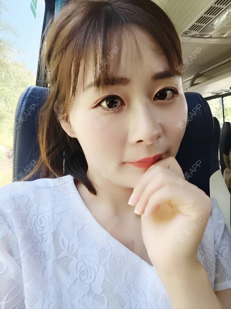 更美 - 更美用户srpv6JiXYY的玻尿酸苹果肌经验 | 玻尿酸苹果肌 | 上海