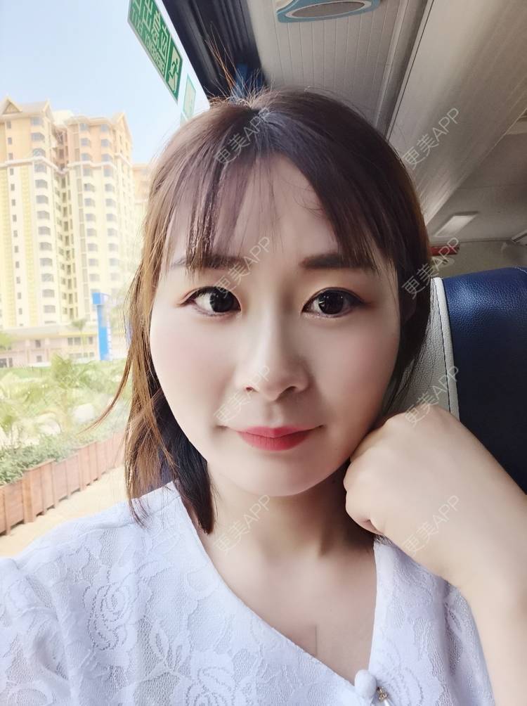 更美 - 更美用户srpv6JiXYY的玻尿酸苹果肌经验 | 玻尿酸苹果肌 | 上海