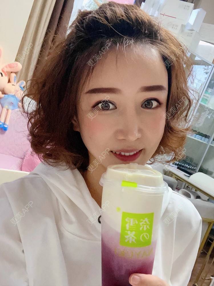 更美 - ⒈心只为你恳的综合去眼袋经验 | 北京 | 内切去眼袋 | 视频日记 | 综合去眼袋
