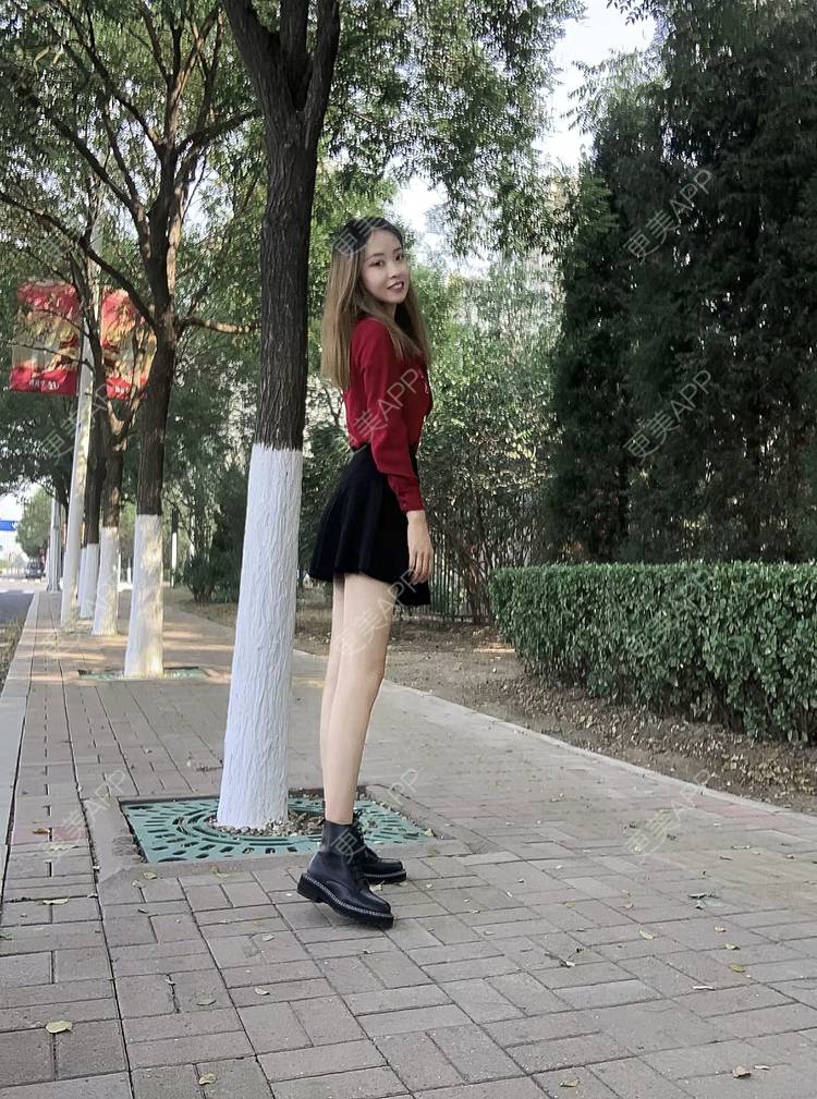 更美 - 丹妮88的吸脂瘦大腿经验 | 广州 | 吸脂瘦大腿