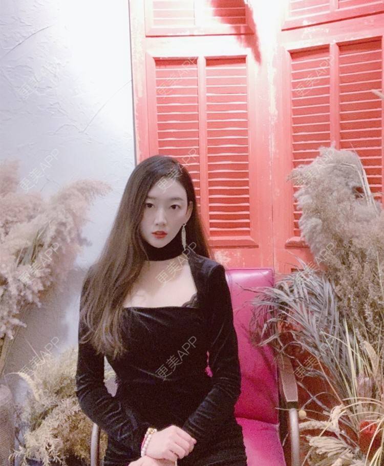 更美 - 更美用户njuluUhApQ的瘦脸经验 | V脸套餐 | 瘦脸 | 青岛