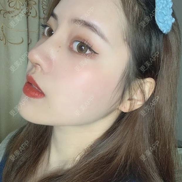 放手幸福的鼻综合日记