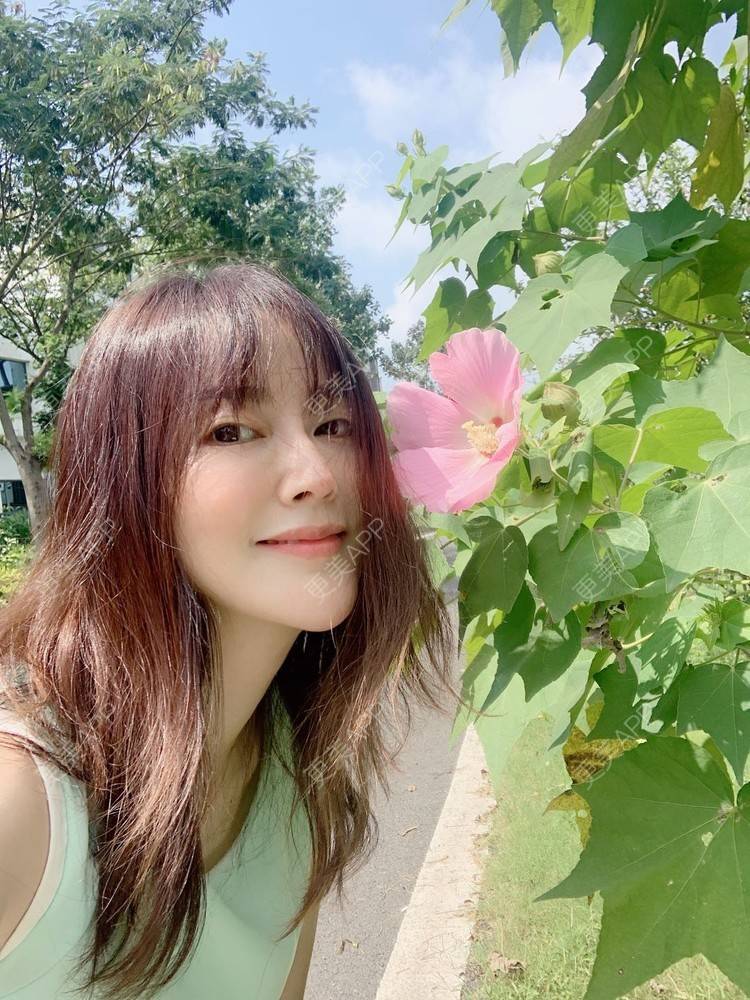 更美 - 更美用户tmzA925IQh的埋线提升经验 | 上海 | 埋线提升