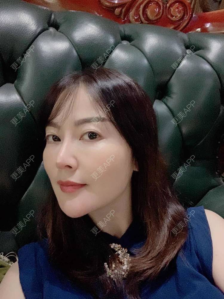 更美 - 更美用户tmzA925IQh的埋线提升经验 | 上海 | 埋线提升 | 视频日记