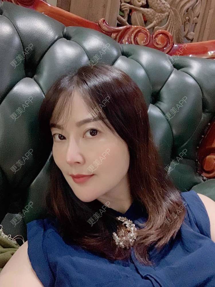 更美 - 更美用户tmzA925IQh的埋线提升经验 | 上海 | 埋线提升 | 视频日记