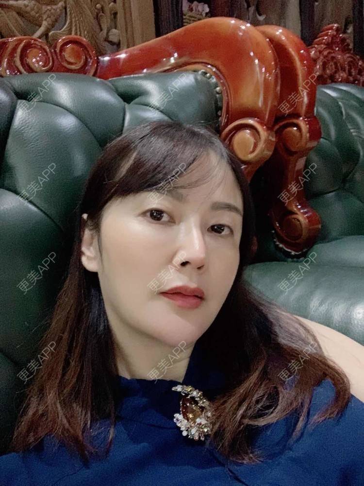 更美 - 更美用户tmzA925IQh的埋线提升经验 | 上海 | 埋线提升 | 视频日记