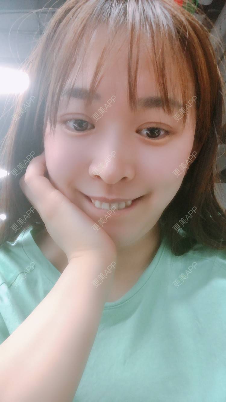 更美 - 更美用户nOSa2OXrxm的冷光美白经验 | 北京 | 冷光美白