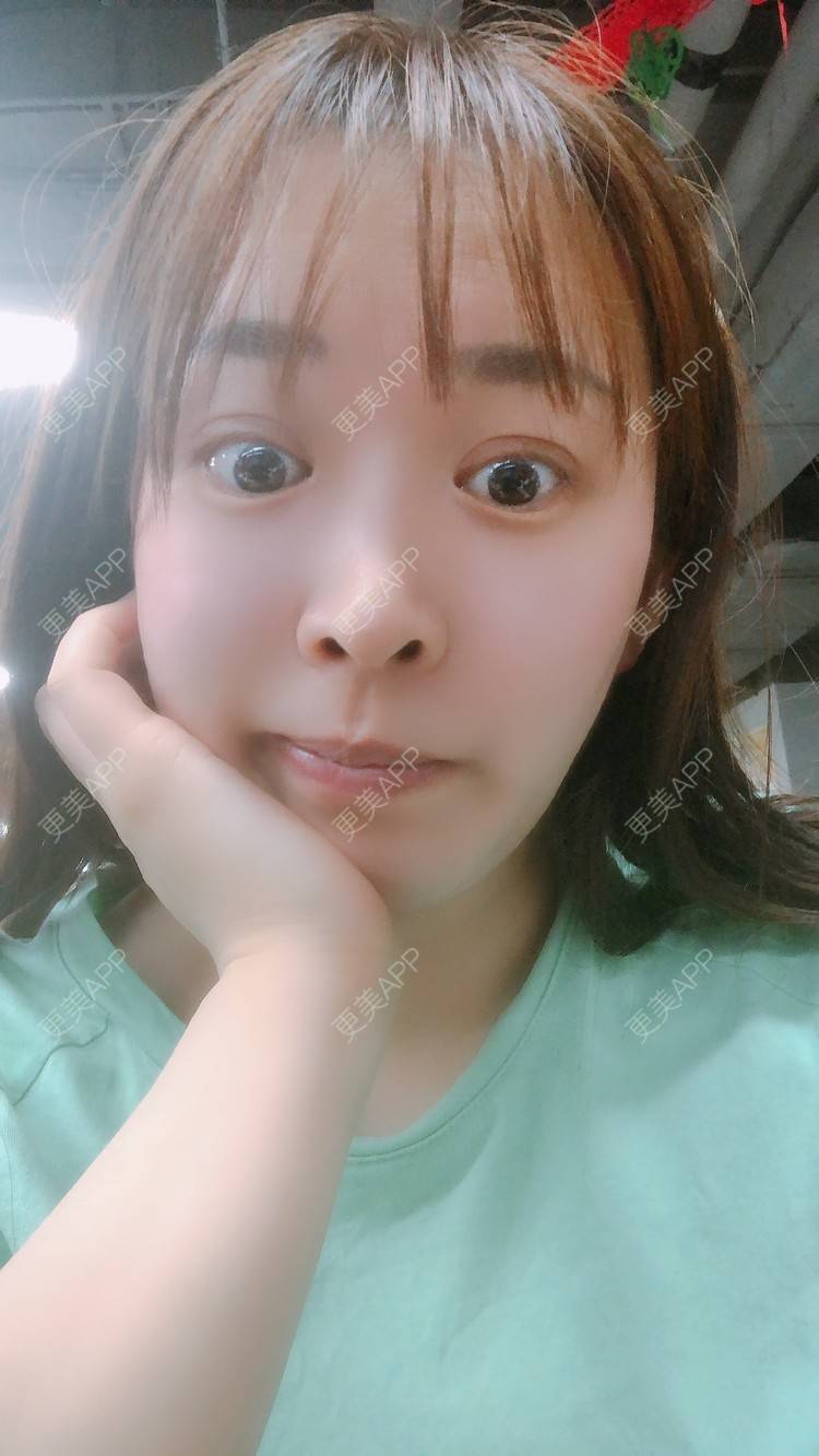更美 - 更美用户nOSa2OXrxm的冷光美白经验 | 北京 | 冷光美白