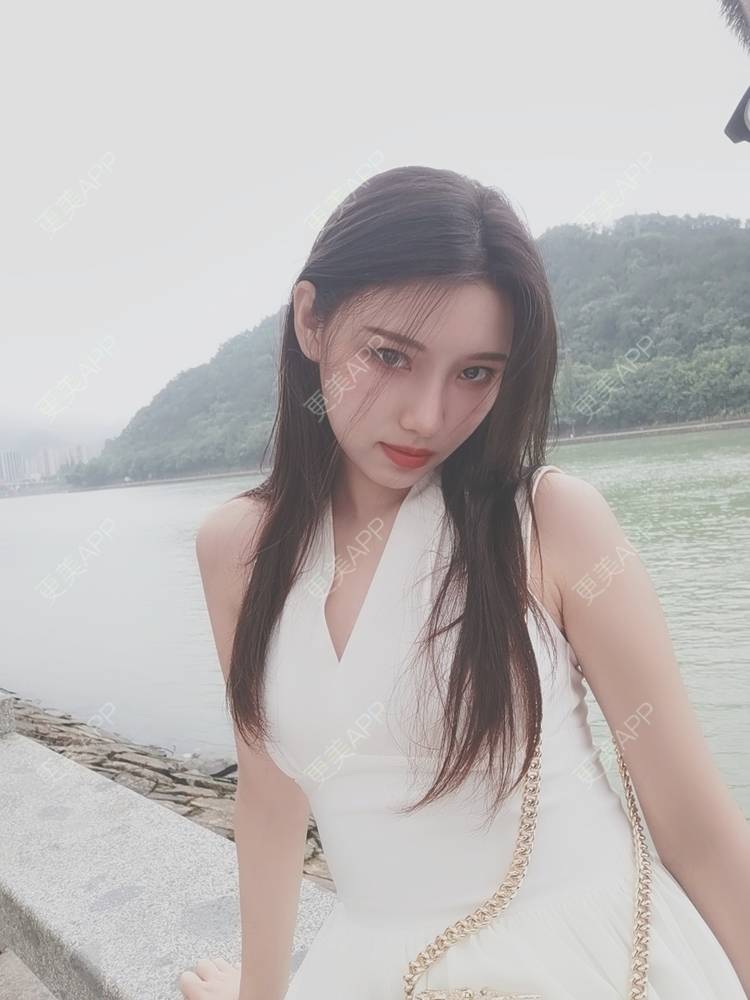 更美 - 更美用户82701801的隐形牙齿矫正经验 | 杭州