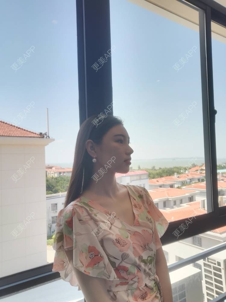 更美 - 更美用户82701801的隐形牙齿矫正经验 | 杭州