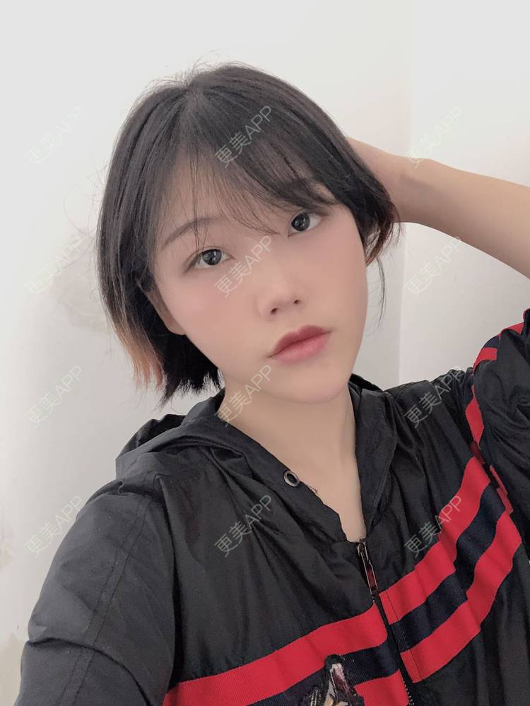 更美 - 女王啊@朴的硅胶垫下巴经验 | 深圳 | 硅胶垫下巴