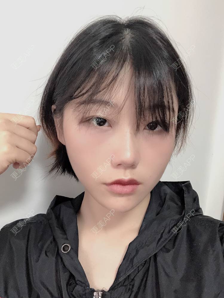 更美 - 女王啊@朴的硅胶垫下巴经验 | 深圳 | 硅胶垫下巴