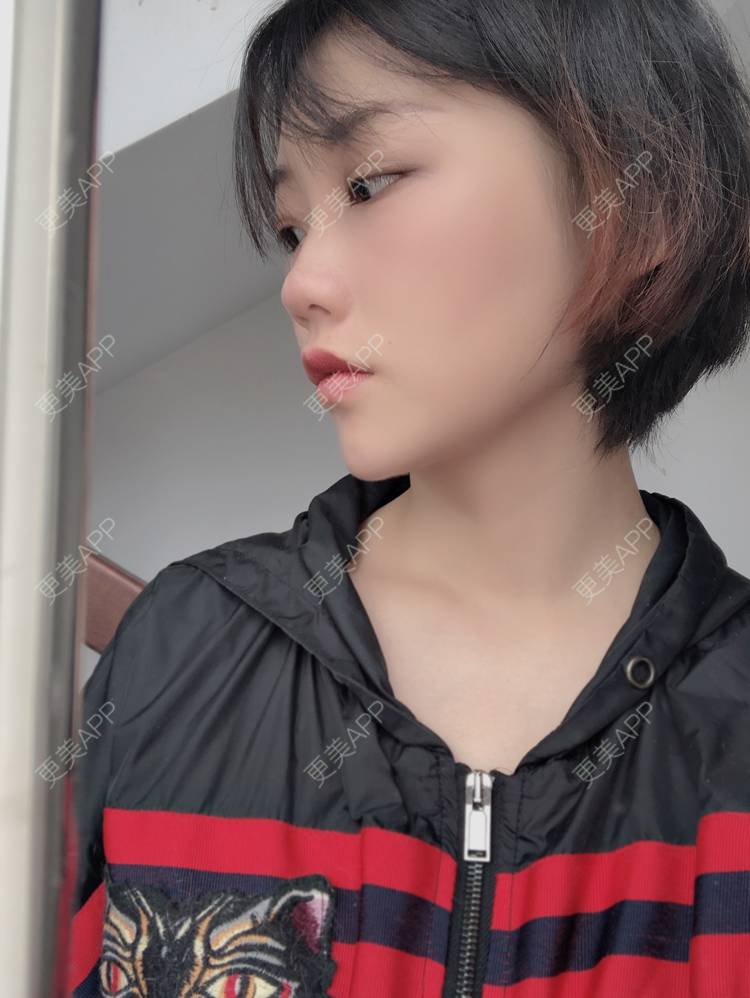 更美 - 女王啊@朴的硅胶垫下巴经验 | 深圳 | 硅胶垫下巴