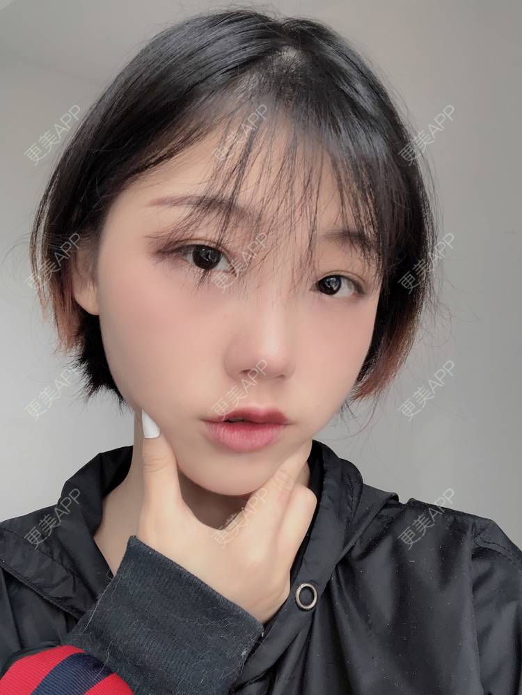 更美 - 女王啊@朴的硅胶垫下巴经验 | 深圳 | 硅胶垫下巴