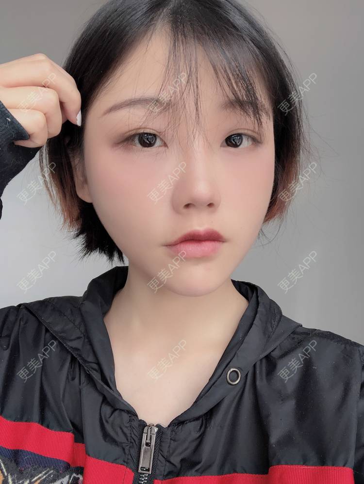 更美 - 女王啊@朴的硅胶垫下巴经验 | 深圳 | 硅胶垫下巴