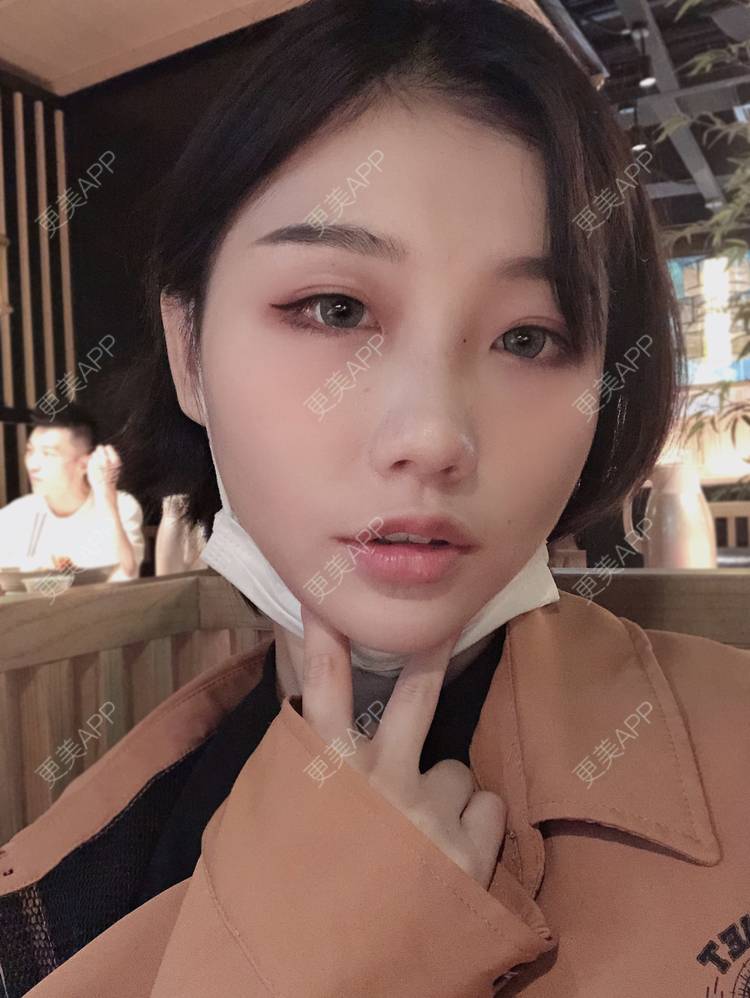 更美 - 女王啊@朴的硅胶垫下巴经验 | 深圳 | 硅胶垫下巴