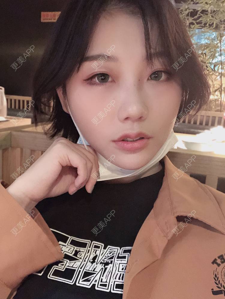 更美 - 女王啊@朴的硅胶垫下巴经验 | 深圳 | 硅胶垫下巴