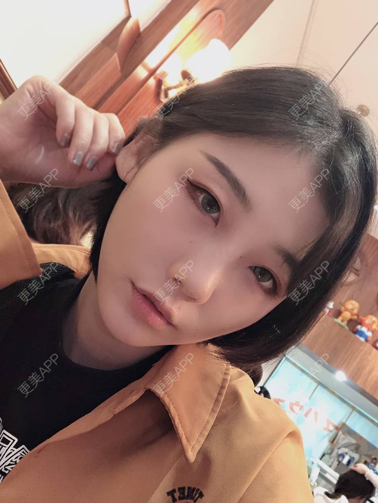 更美 - 女王啊@朴的硅胶垫下巴经验 | 深圳 | 硅胶垫下巴