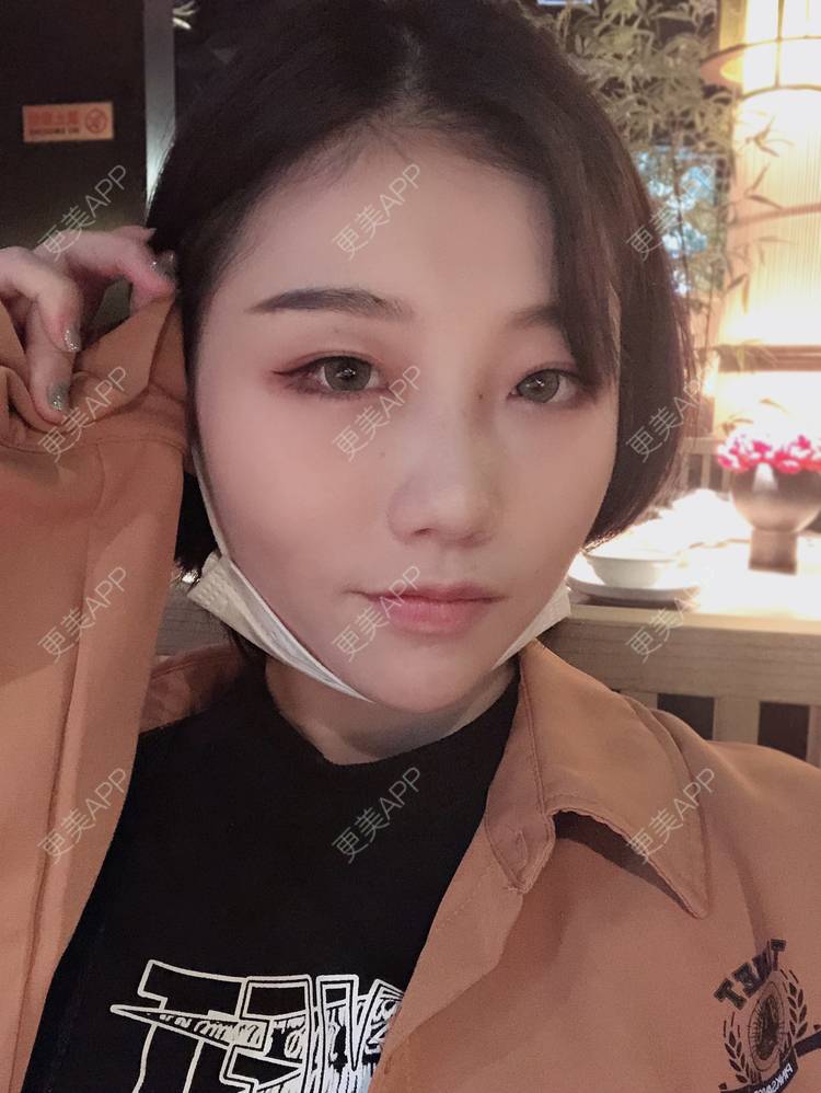更美 - 女王啊@朴的硅胶垫下巴经验 | 深圳 | 硅胶垫下巴