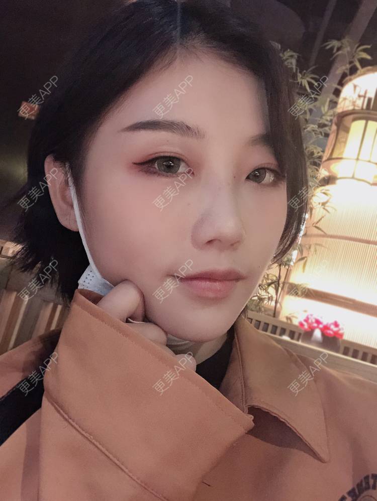 更美 - 女王啊@朴的硅胶垫下巴经验 | 深圳 | 硅胶垫下巴