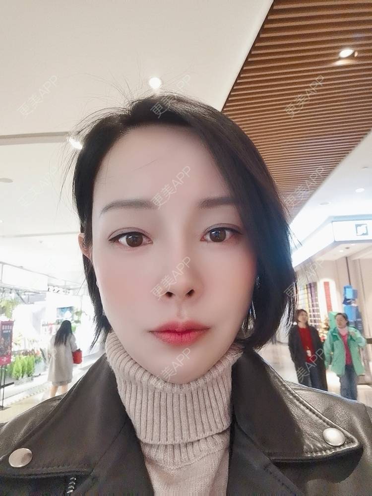 更美 - 🐷🐮仔仔仔的热玛吉经验 | 上海 | 热玛吉