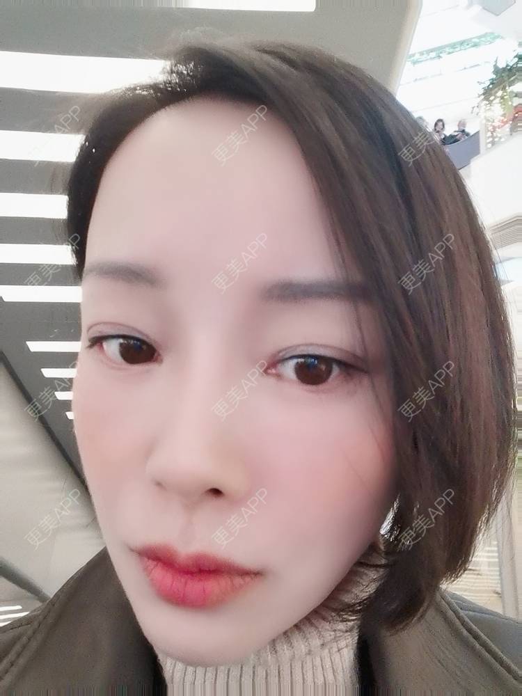 更美 - 🐷🐮仔仔仔的热玛吉经验 | 上海 | 热玛吉