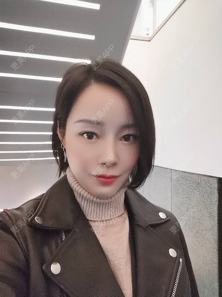 更美 - 🐷🐮仔仔仔的热玛吉经验 | 上海 | 热玛吉