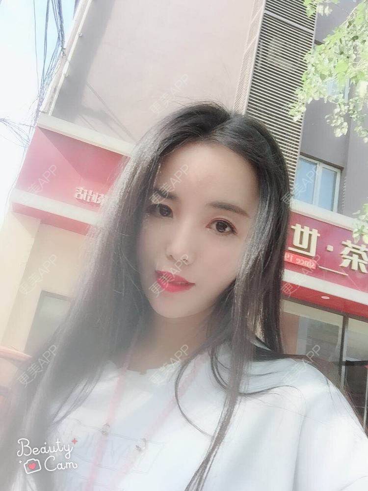 更美 - 活成一首诗的自体脂肪面部年轻化经验 | 北京 | 自体脂肪面部年轻化