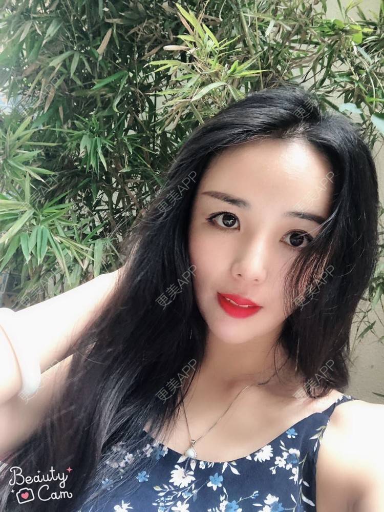 更美 - 活成一首诗的自体脂肪面部年轻化经验 | 北京 | 自体脂肪面部年轻化