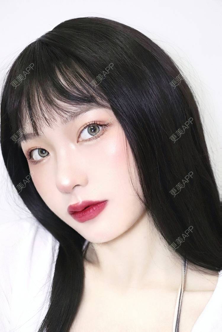 更美 - 更美用户akk91yDUSK的玻尿酸唇部经验 | 玻尿酸唇部