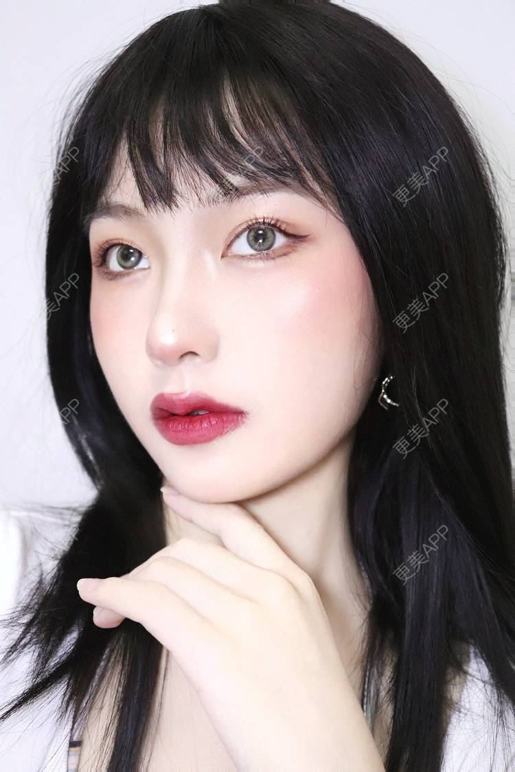 更美 - 更美用户akk91yDUSK的玻尿酸唇部经验 | 玻尿酸唇部