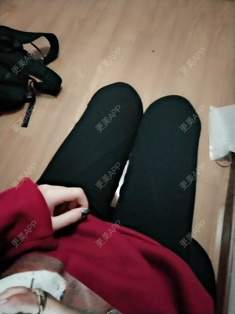 更美 - 哑琳的自体脂肪丰苹果肌经验 | 自体脂肪丰苹果肌 | 自体脂肪垫下巴 | 自体脂肪丰额头 | 自体脂肪填充法令纹 | 深圳 | 自体脂肪全面部填充