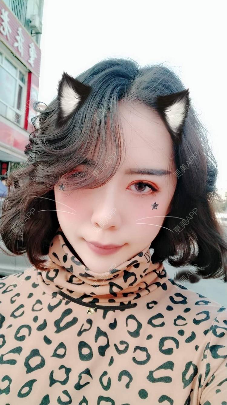 更美 - 哑琳的自体脂肪丰苹果肌经验 | 自体脂肪丰苹果肌 | 自体脂肪垫下巴 | 自体脂肪丰额头 | 自体脂肪填充法令纹 | 深圳 | 自体脂肪全面部填充