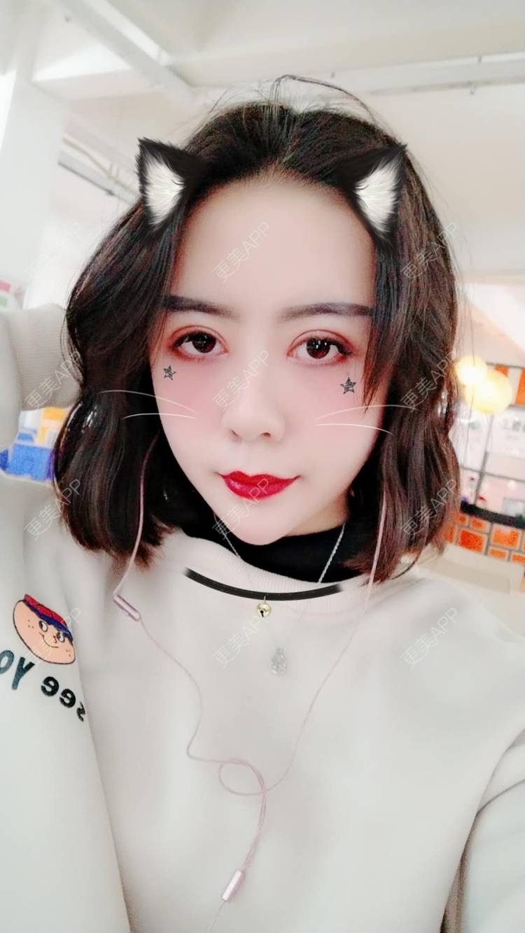 更美 - 哑琳的自体脂肪丰苹果肌经验 | 自体脂肪丰苹果肌 | 自体脂肪垫下巴 | 自体脂肪丰额头 | 自体脂肪填充法令纹 | 深圳 | 自体脂肪全面部填充