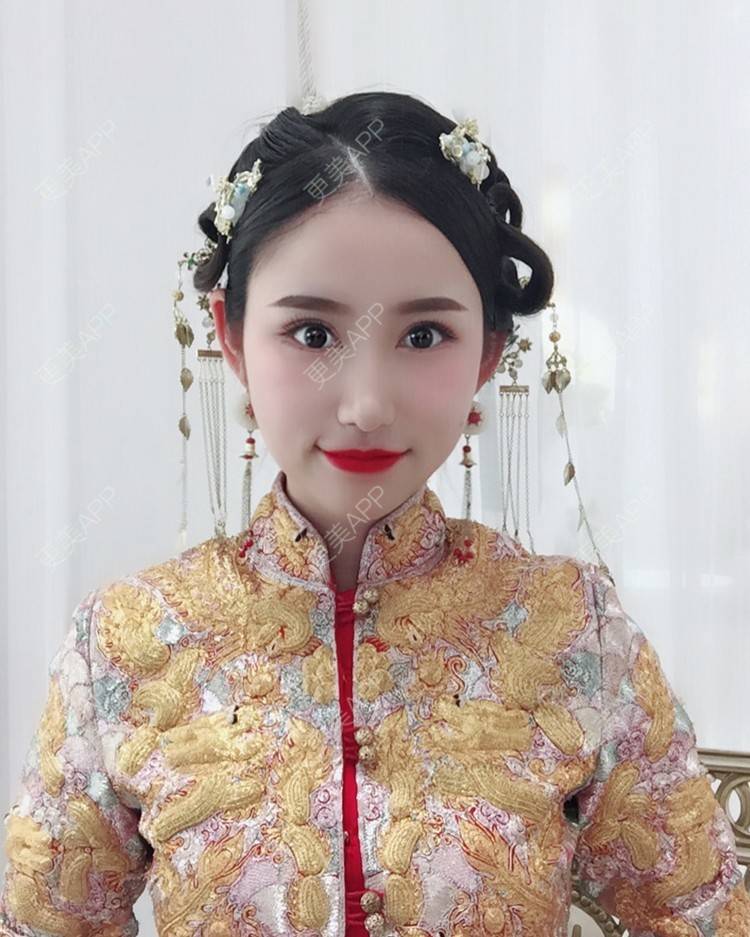 更美 - 指尖流露的全切双眼皮经验 | 成都 | 视频日记 | 全切双眼皮 | 双眼皮