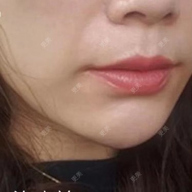 涂艳丽 医生