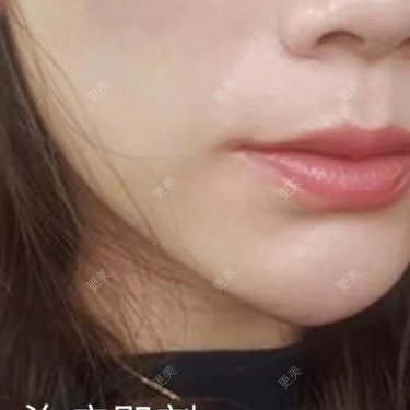 涂艳丽 医生